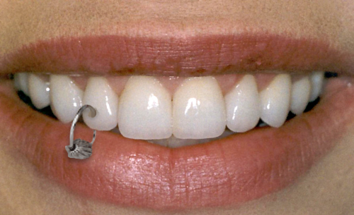 Teeth Jewelry - Picture | eBaum's World
