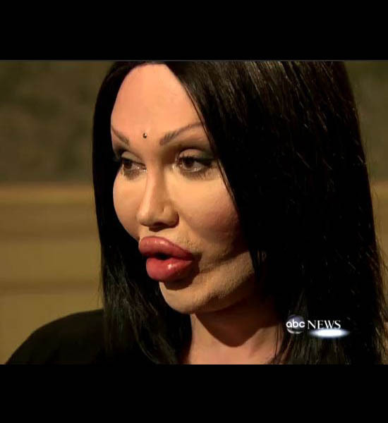 Plastic Surgery Pictures That Will Scare You Wtf Gallery Ebaum S World