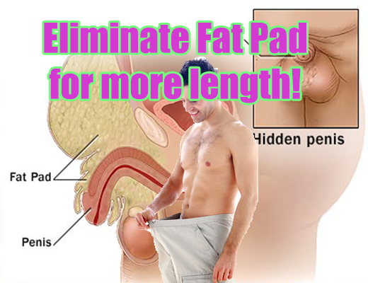 How To Lose Fat Around Penis 12