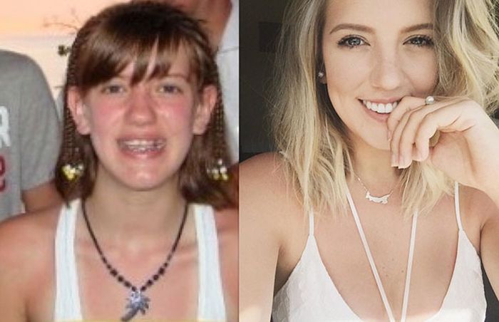 1 - 25 People That Went Through Amazing Transformations After Puberty