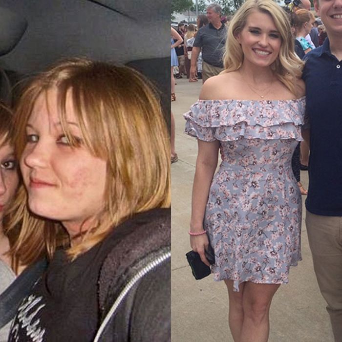 3 - 25 People That Went Through Amazing Transformations After Puberty
