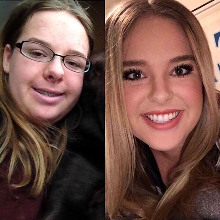 9 - 25 People That Went Through Amazing Transformations After Puberty