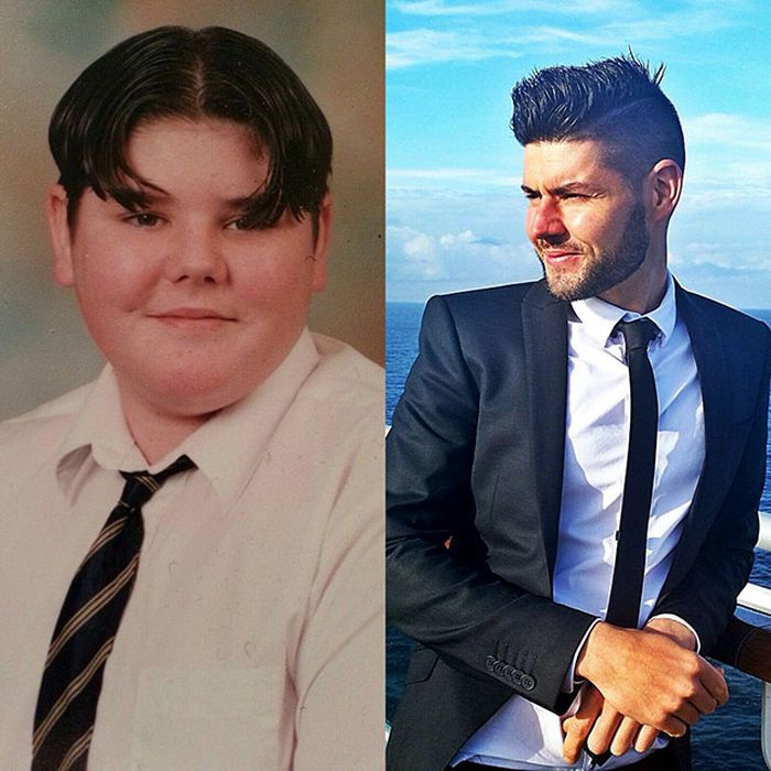 15 - 25 People That Went Through Amazing Transformations After Puberty