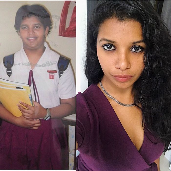 17 - 25 People That Went Through Amazing Transformations After Puberty