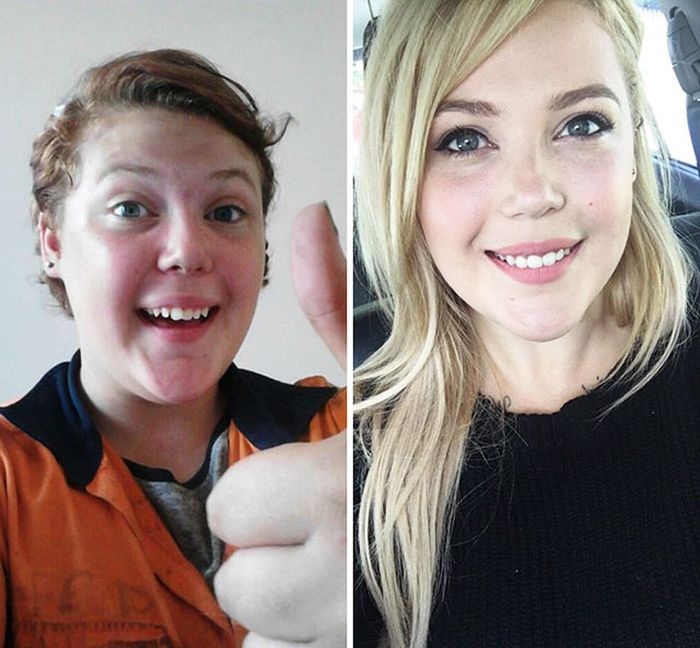 19 - 25 People That Went Through Amazing Transformations After Puberty