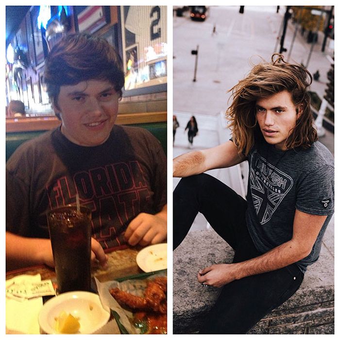 22 - 25 People That Went Through Amazing Transformations After Puberty