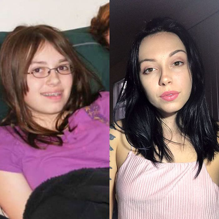 24 - 25 People That Went Through Amazing Transformations After Puberty