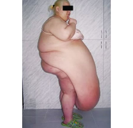 Fat Lady Vagina 16