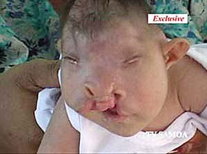 deformed baby - Picture | eBaum's World
