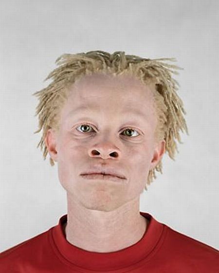 Albino Black Ppl