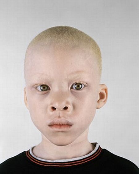 albino4.jpg