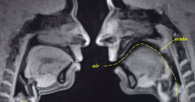 What Life Looks Like Through An MRI - Science & Technology Video