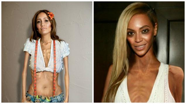 14 Celebrities Who Had Suffered From Anorexia Funny Gallery Ebaums