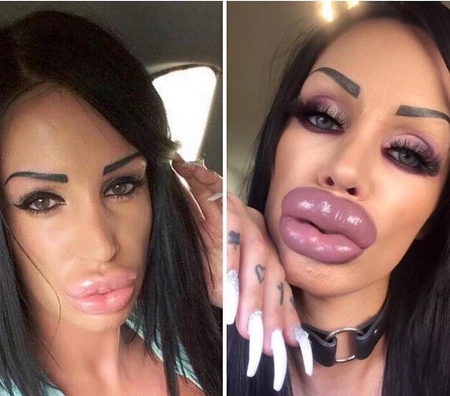 21 People Who Took Plastic Surgery Too Far Wtf Gallery EBaum S World