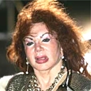 Jackie Stallone After Face Lift