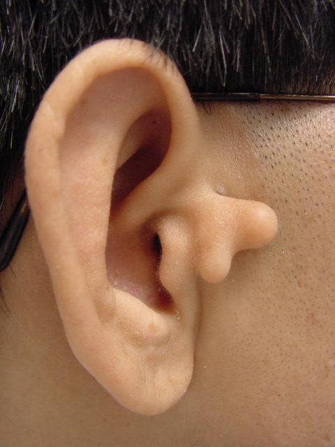 Ear Testicles