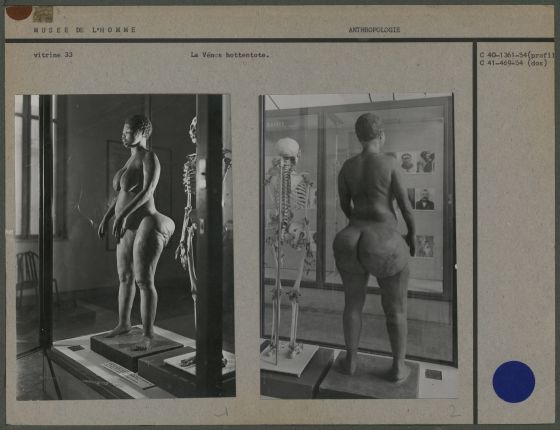 Body of Sarah Baartman displayed as part of the history of colonialism at the Museum of Man in Paris. Baartman was exhibited first in London, entertaining people because of her "exotic" origin and by showing what were thought of as highly unusual bodily features. Even after death she remained disrespected.