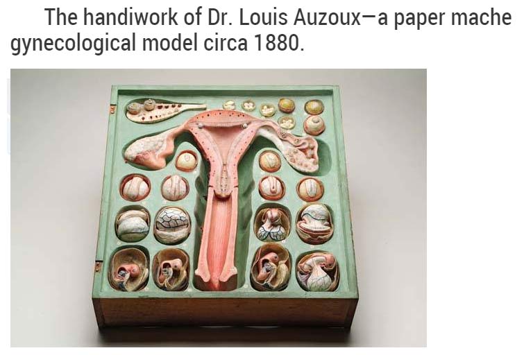 old medical stuff - The handiwork of Dr. Louis Auzouxa paper mache gynecological model circa 1880. Oo 200