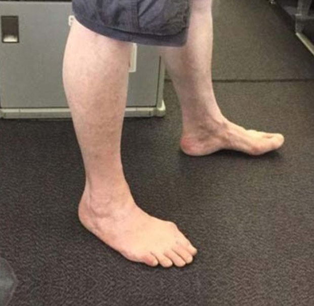 This man who likes to fly barefoot.