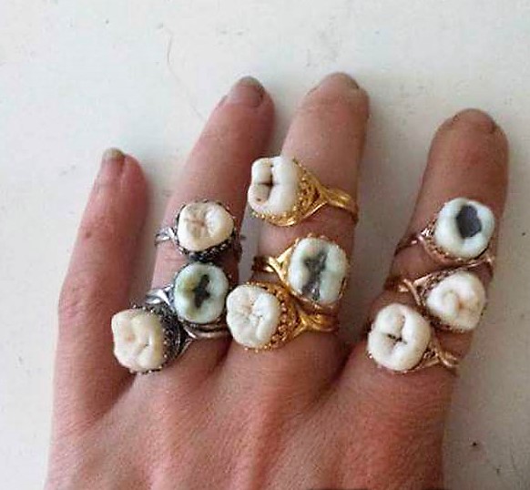 tooth ring
