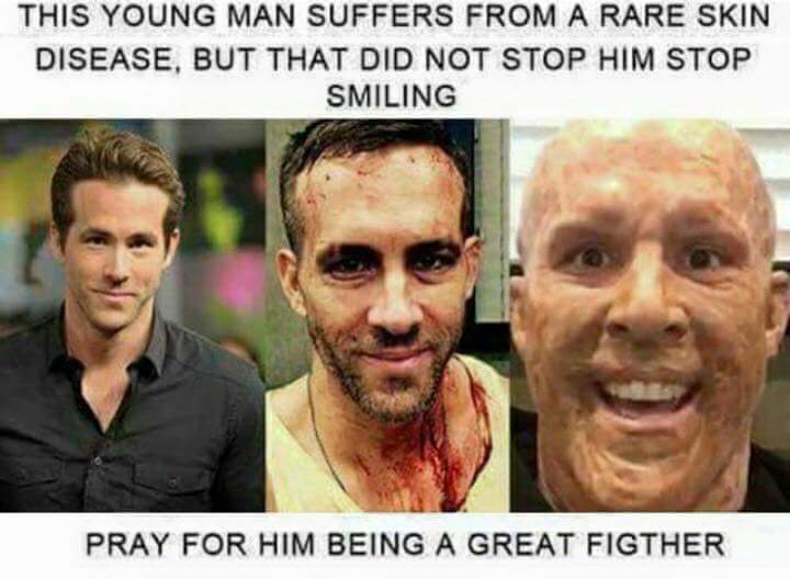 deadpool 1 like 1 prayer - This Young Man Suffers From A Rare Skin Disease, But That Did Not Stop Him Stop Smiling Pray For Him Being A Great Figther