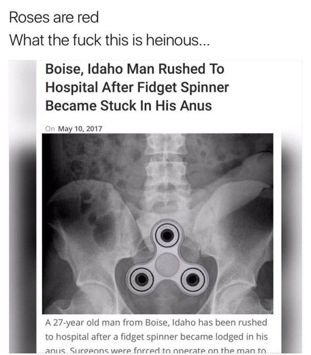 cool medical imaging - Roses are red What the fuck this is heinous... Boise, Idaho Man Rushed To Hospital After Fidget Spinner Became Stuck In His Anus On A 27year old man from Boise, Idaho has been rushed to hospital after a fidget spinner became lodged 