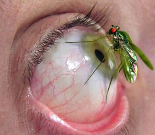 green mosquito on a green bloodshot eye