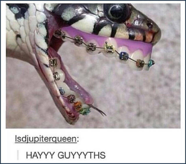 snake with braces - Isdjupiterqueen Hayyy Guyyyths
