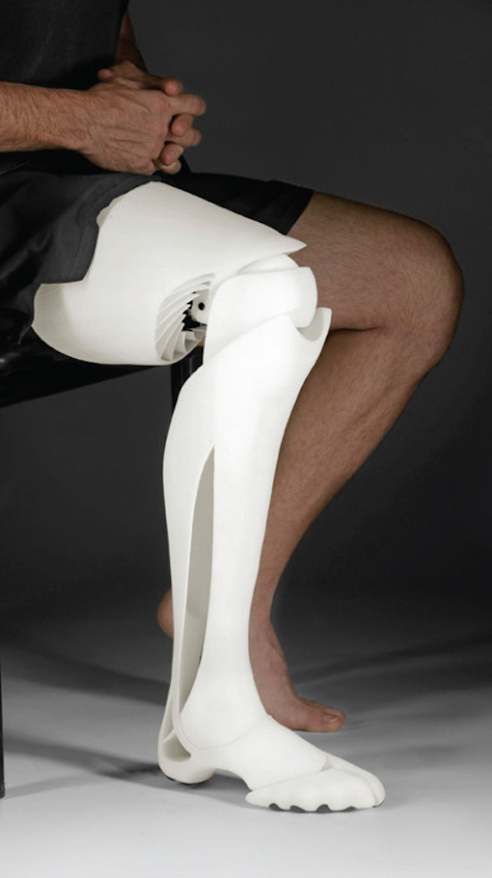 random 3d printed prosthetic leg