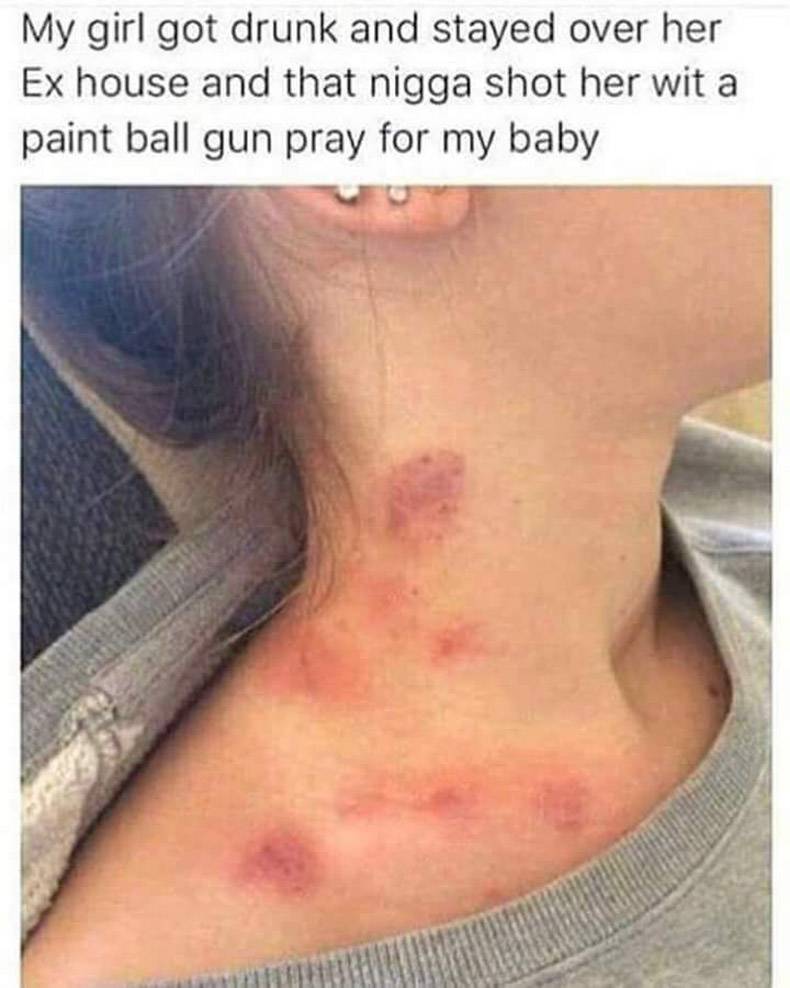 my girl got shot with a paintball gun - My girl got drunk and stayed over her Ex house and that nigga shot her wit a paint ball gun pray for my baby