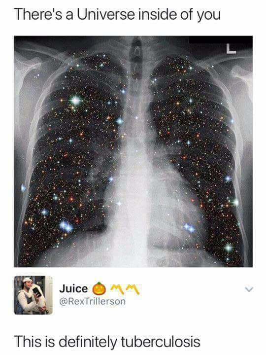 x-ray with stars overlay joked to be tuberculosis