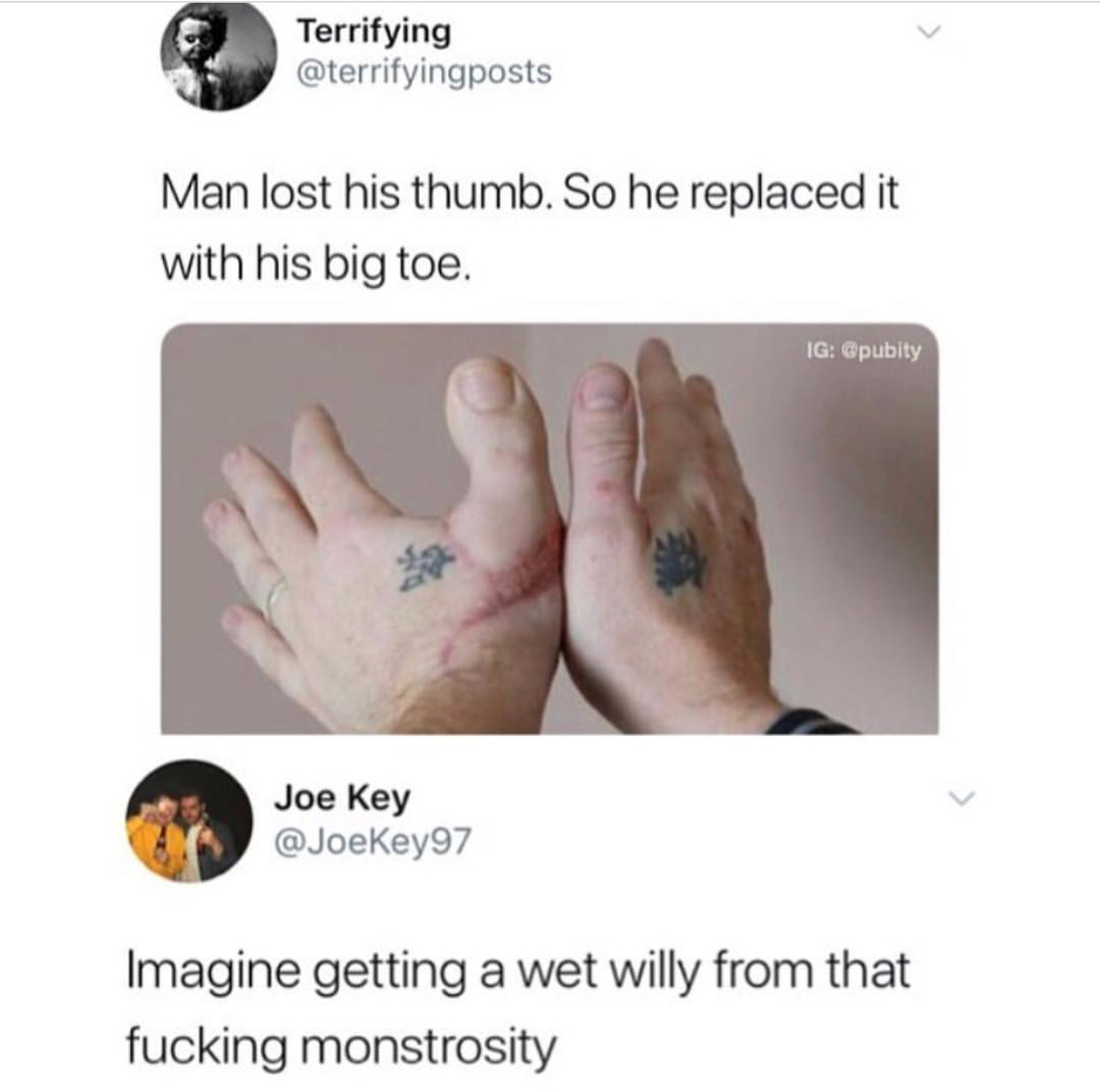 wet willy meme - Terrifying Man lost his thumb. So he replaced it with his big toe. Ig Joe Key Imagine getting a wet willy from that fucking monstrosity