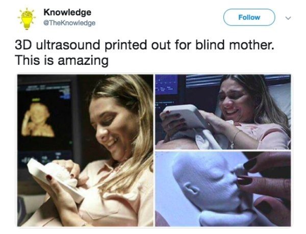 photo caption - Knowledge 3D ultrasound printed out for blind mother. This is amazing