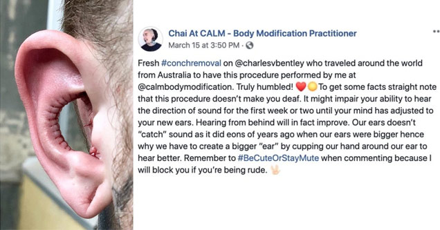 Guy Gets Roasted Online For His Ridiculous Body Modification