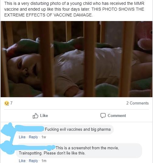 Bullshitters called out - video - This is a very disturbing photo of a young child who has received the Mmr vaccine and ended up this four days later. This Photo Shows The Extreme Effects Of Vaccine Damage 2 Comment Fucking evil vaccines and big pharma 1w