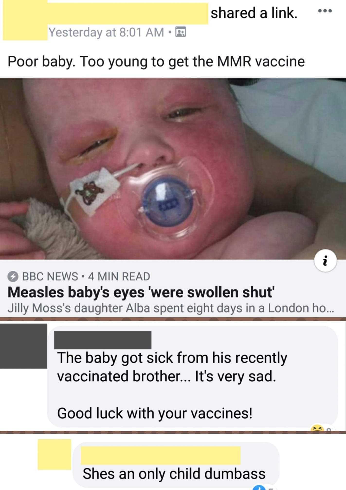 Bullshitters called out - lip - d a link. ... Yesterday at Poor baby. Too young to get the Mmr vaccine Bbc News 4 Min Read Measles baby's eyes 'were swollen shut' Jilly Moss's daughter Alba spent eight days in a London ho... The baby got sick from his rec