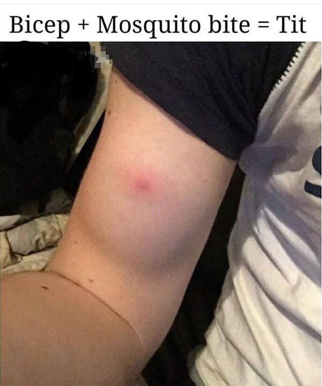 Mosquito meme that says 1 tit - Bicep Mosquito bite Tit