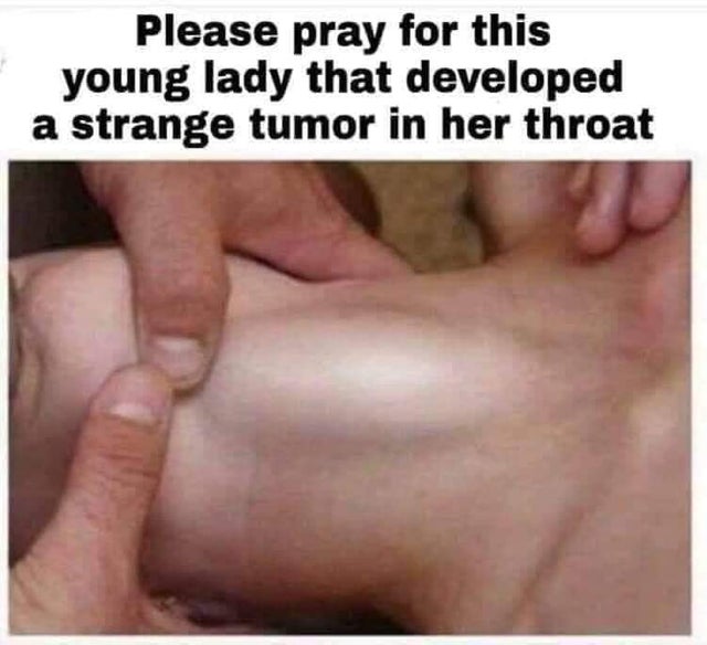 porn memes - manual handling signs Please pray for this young lady that developed a strange tumor in her throat