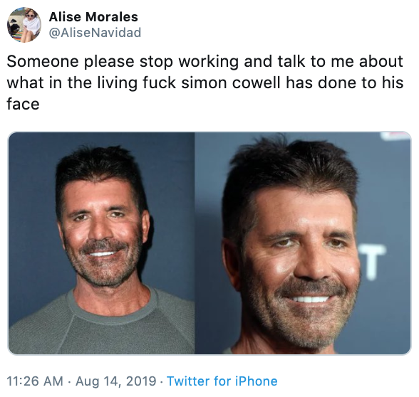 Simon Cowell Facelift Memes and Reactions 