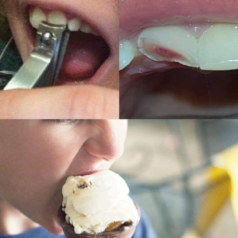 teeth nail clipper ice cream