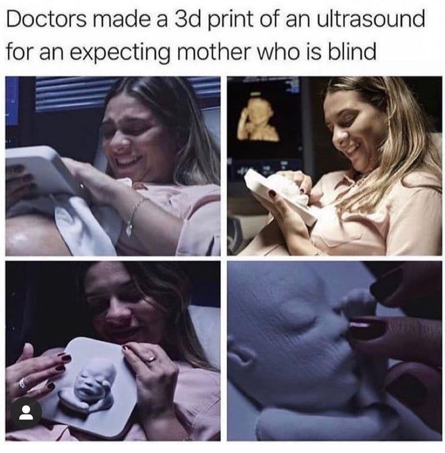 blind mother 3d ultrasound - Doctors made a 3d print of an ultrasound for an expecting mother who is blind