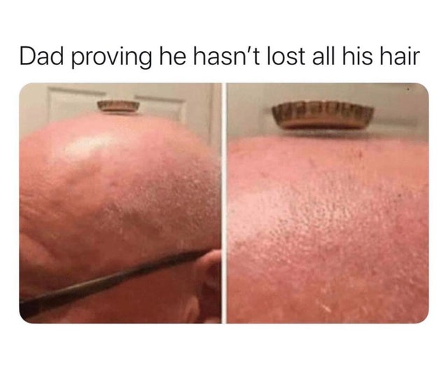 dad proves he has hair - Dad proving he hasn't lost all his hair