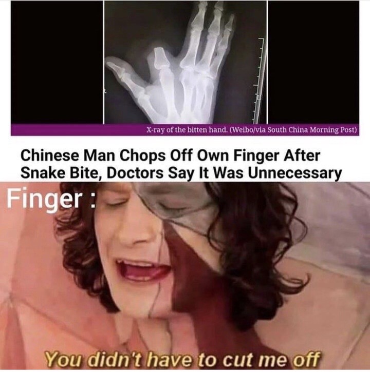 foreskin meme - Xray of the bitten hand. Weibovia South China Morning Post, Chinese Man Chops Off Own Finger After Snake Bite, Doctors Say It Was Unnecessary Finger You didn't have to cut me off