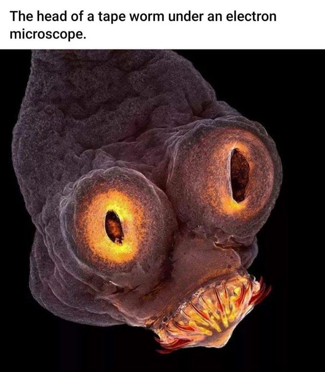 pork tapeworm - The head of a tape worm under an electron microscope.