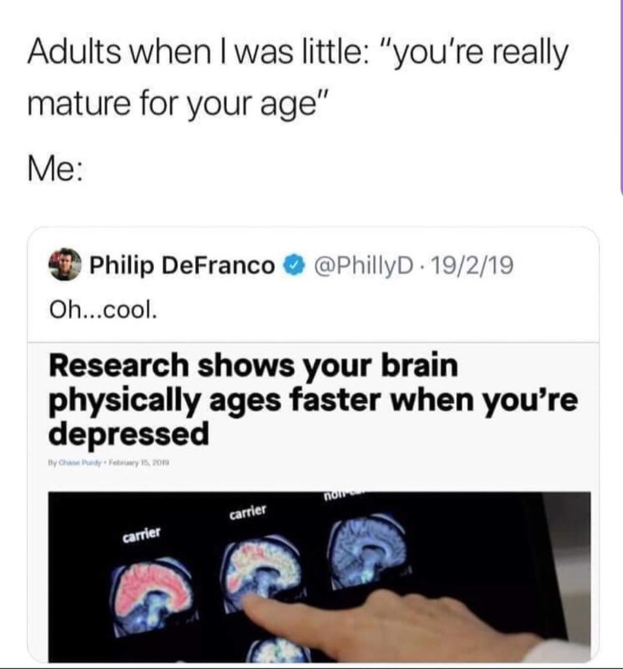 your brain ages faster when you re depressed - Adults when I was little "you're really mature for your age" Me Philip DeFranco . 19219 Oh...cool Research shows your brain physically ages faster when you're depressed By Chandy Fry 15, 2019 non carrier carr