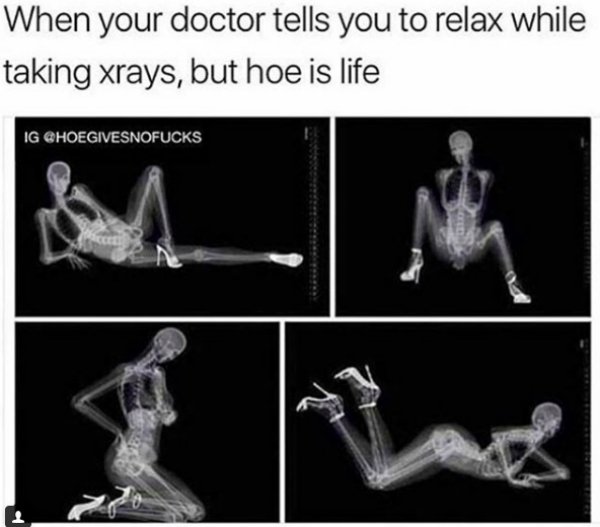 dirty memes, filthy memes, sex memes, NSFW memes, funny dirty memes, porn memes, dirty memes for him, dirty memes for her, dirty memes 2020, funny memes, dirty picsmood dirty sex memes - When your doctor tells you to relax while taking xrays, but hoe is l