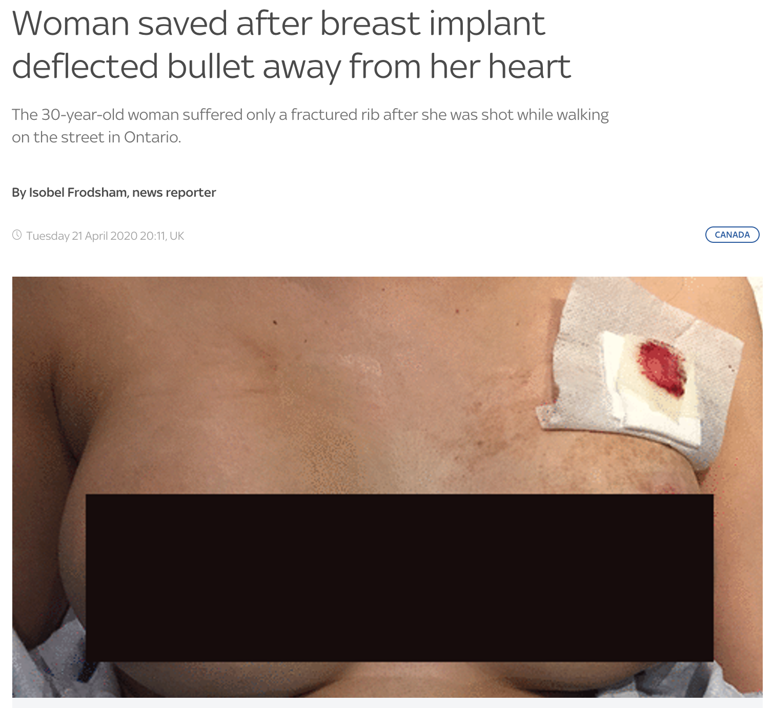 Woman saved after breast implant deflected bullet away from her heart The 30-year-old woman suffered only a fractured rib after she was shot while walking on the street in Ontario