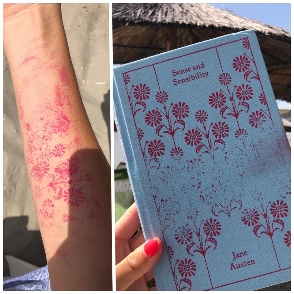 ink on book cover wore off onto girl's arm