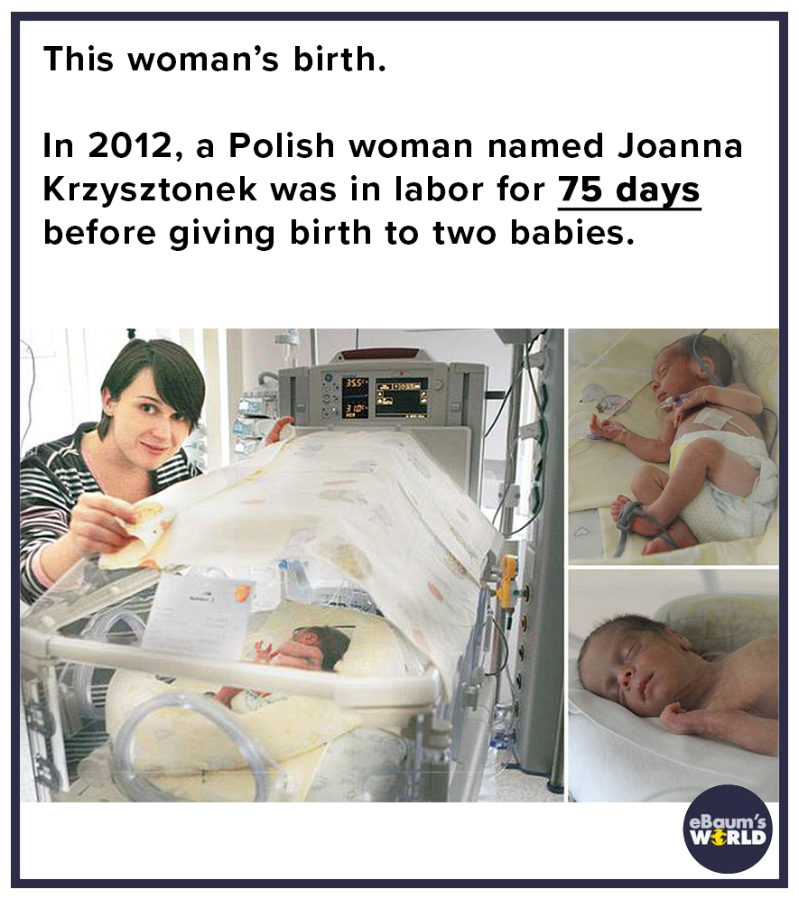 joanna krzysztonek - This woman's birth. In 2012, a Polish woman named Joanna Krzysztonek was in labor for 75 days before giving birth to two babies. eBaum's Wrld