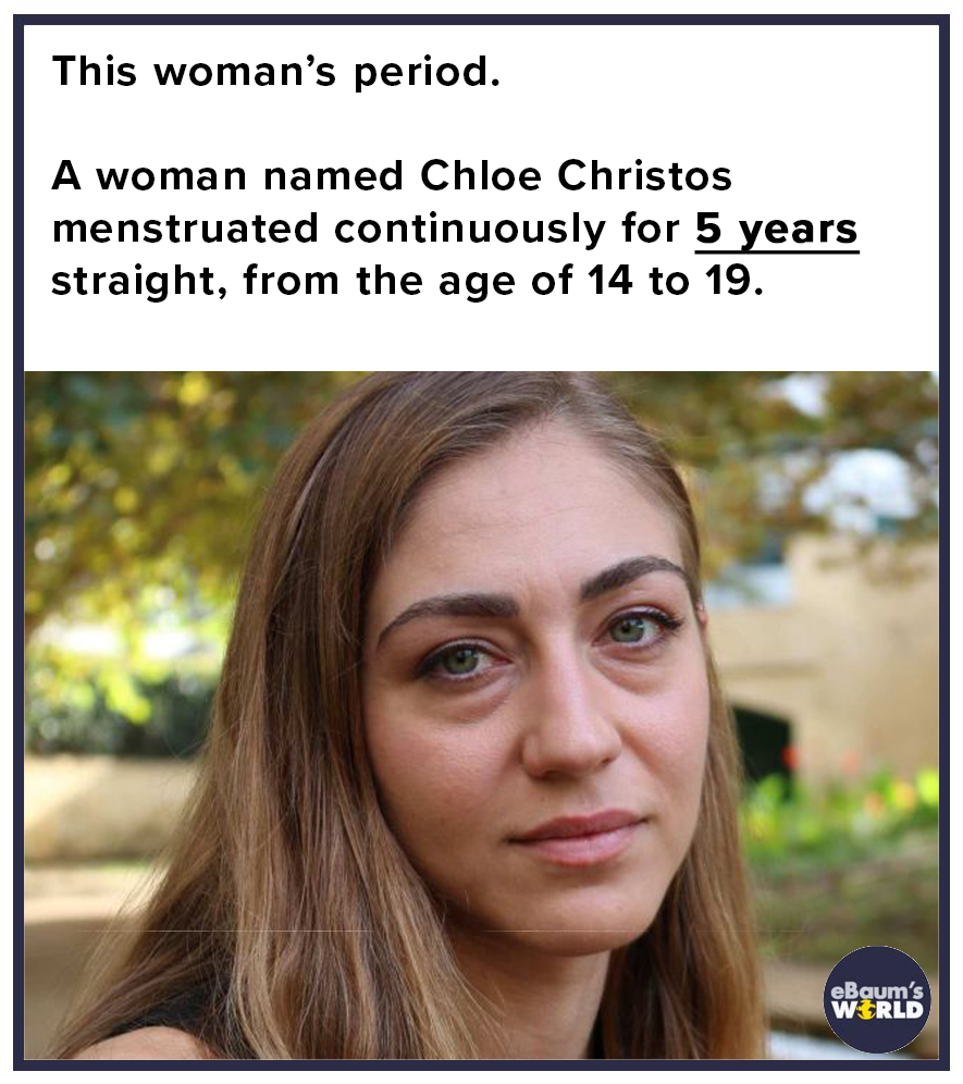 photo caption - This woman's period. A woman named Chloe Christos menstruated continuously for 5 years straight, from the age of 14 to 19. eBaum's World